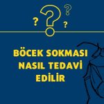 Böcek Sokması Nasıl Tedavi Edilir